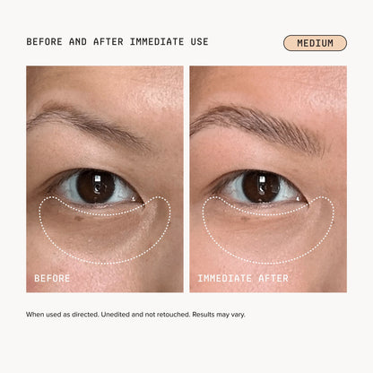 🎉Last Day Buy 1 Get 1 Free🎉Turonu Brightening Eye Corrector
