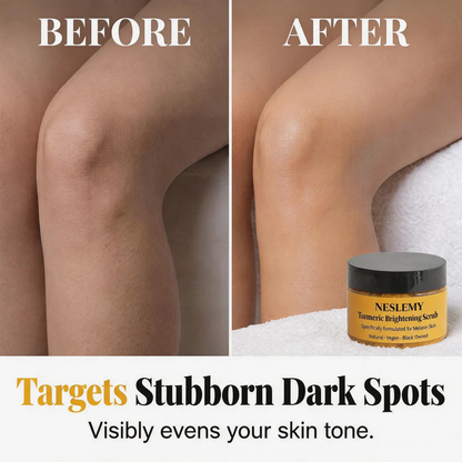 🏆 LIMITED-TIME 30% OFF! ✨Turmeric Exfoliating Body Scrub