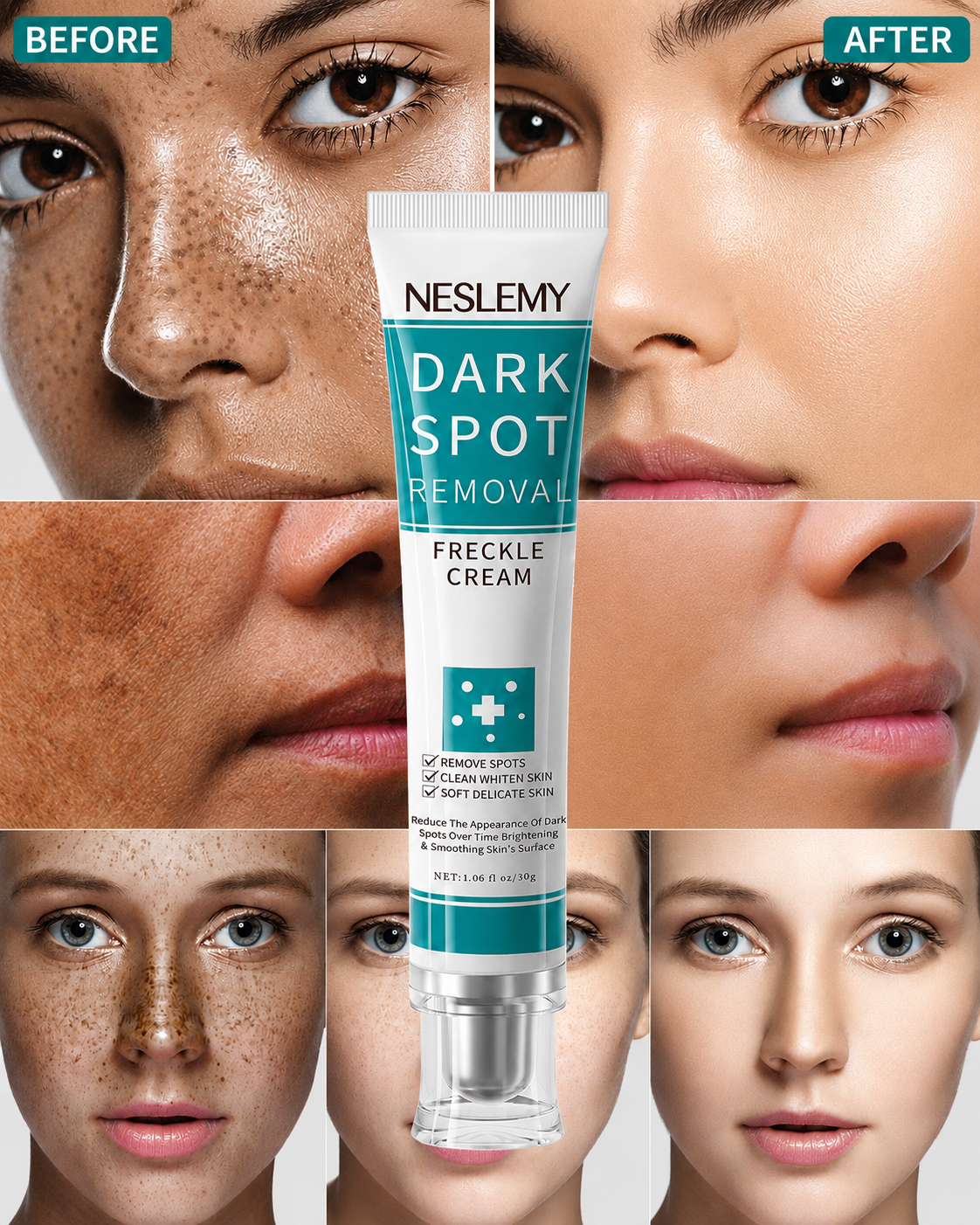 ✨Dark Spot Removal Cream That Helps Reveal Brighter, Healthier-Looking Skin
