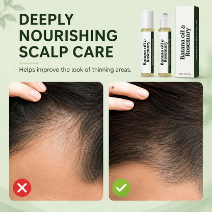 Rosemary & Batana Scalp Serum Roll-On – Daily Hair & Scalp Support for Fuller-Looking Hair
