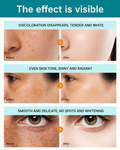 ✨Dark Spot Removal Cream That Helps Reveal Brighter, Healthier-Looking Skin