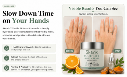 🎁 30% OFF Today! Give Mom the Gift of Soft, Youthful Hands 💕