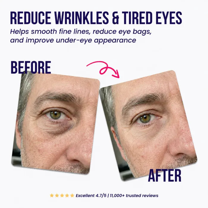 ✨ Under-Eye Repair Patches for Men — Depuff, Smooth & Brighten Tired Eyes ✨